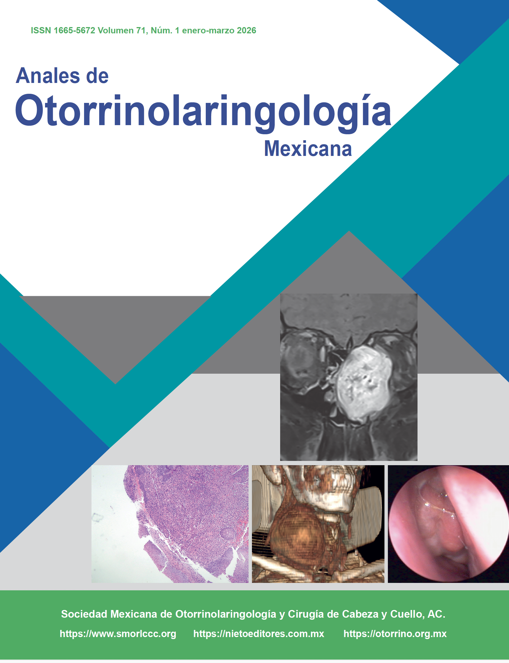 					Ver Vol. 71 Núm. 1 (2026): An Orl Mex 2025; 71 (1). Enero-Marzo
				